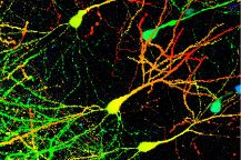Iverson Parkinsons study