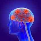 3d illustration of the human brain with Alzheimer's disease - dementia